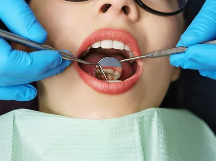 Cosmetic Dentistry Alexandria